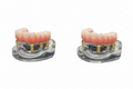 All On Four Implant Model