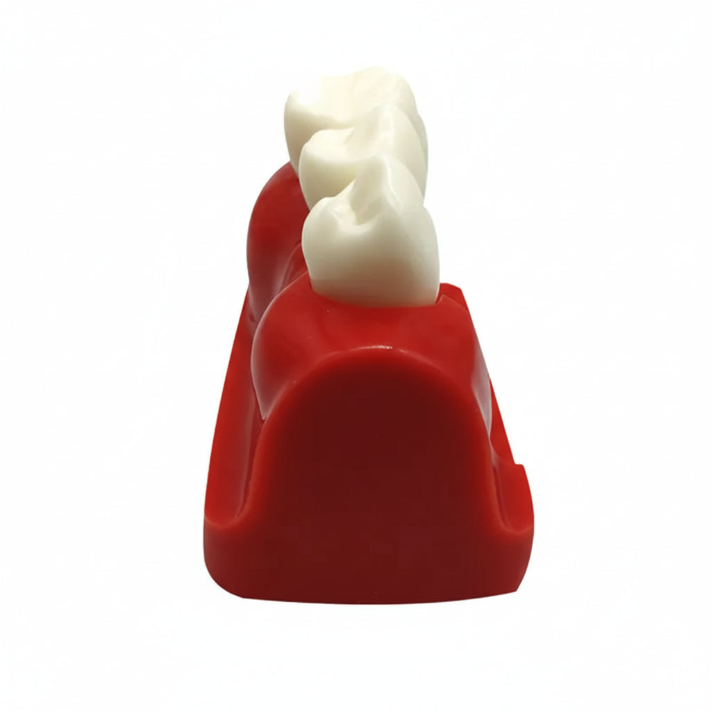 Implant Analysis Model