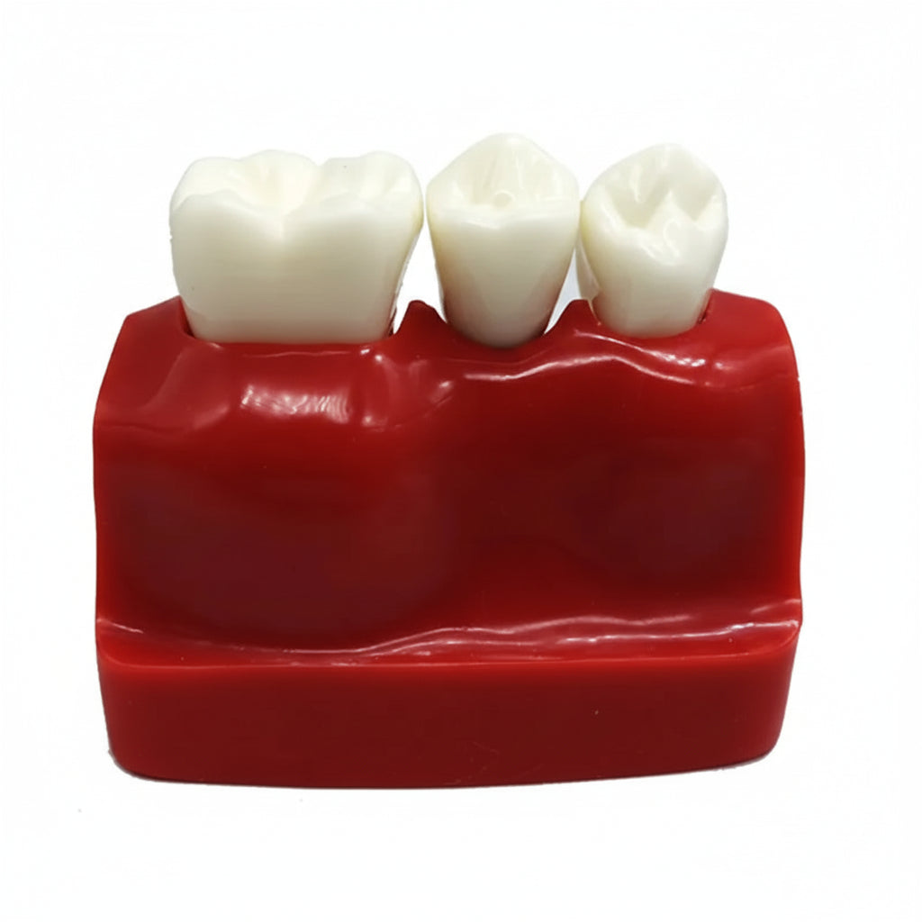 Implant Analysis Model